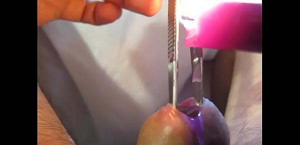  Urethra in hot purple wax